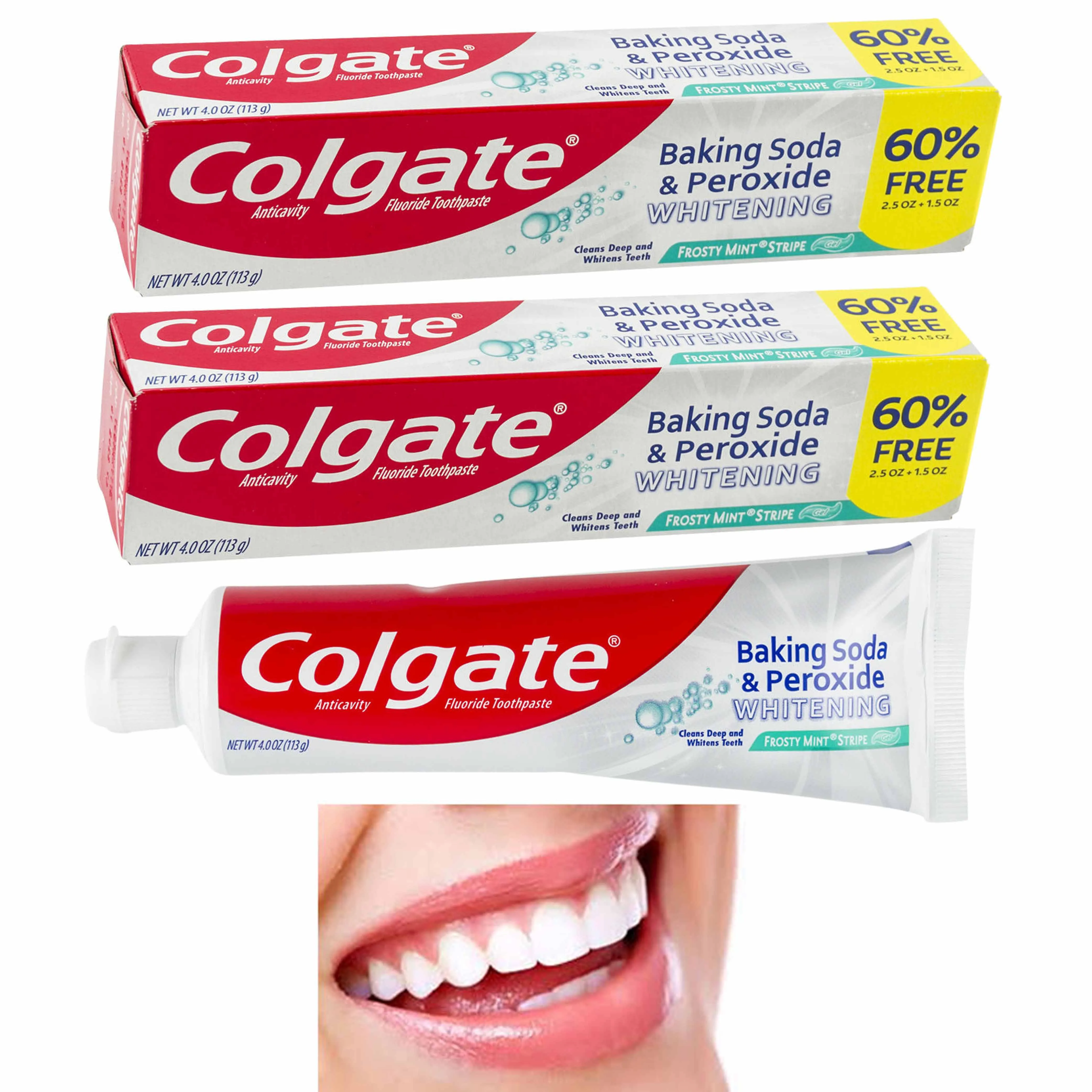 2 Colgate Teeth Whitening Toothpaste Baking Soda Peroxide Oral Anti-Cavity Tooth