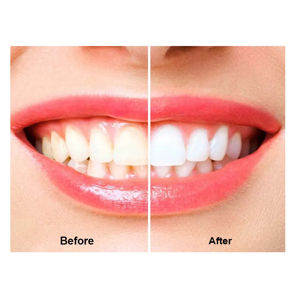 2 Colgate Teeth Whitening Toothpaste Baking Soda Peroxide Oral Anti-Cavity Tooth